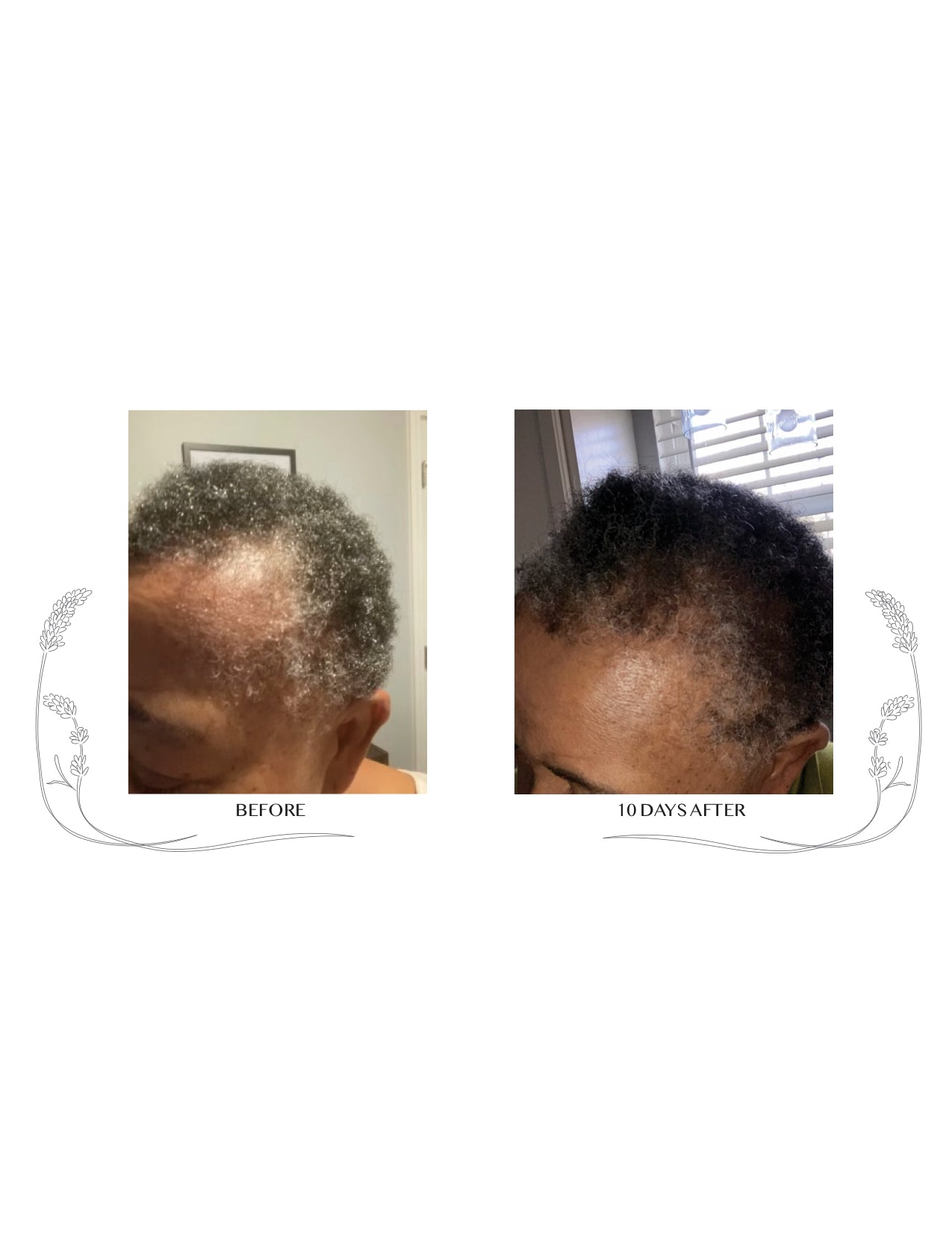 Hair Oil