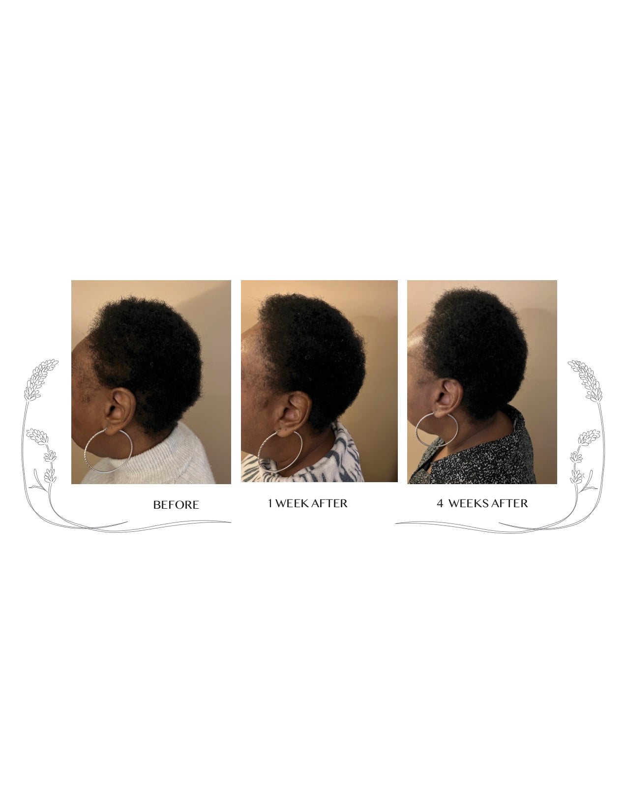 Hair Oil