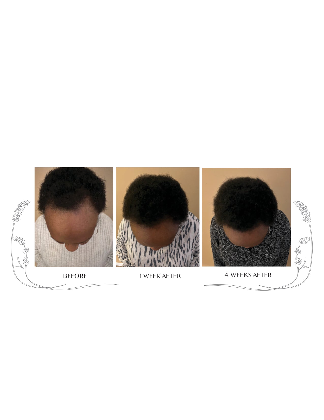Hair Oil
