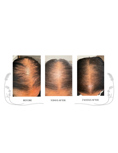 Hair Oil